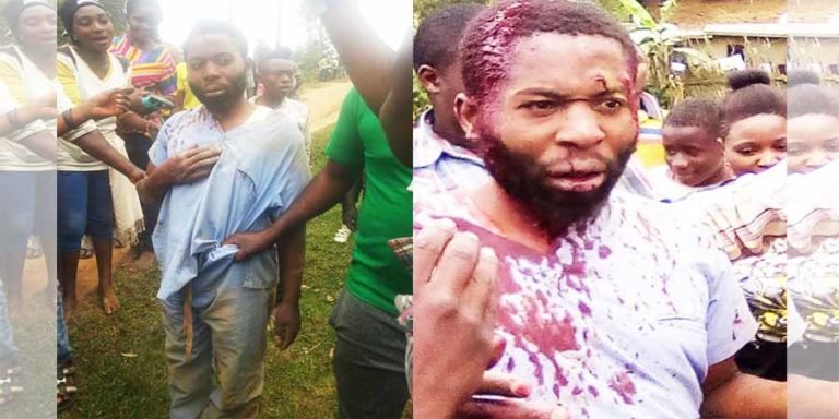 une victime d'agression des jeunes en colère - EBOLA- une