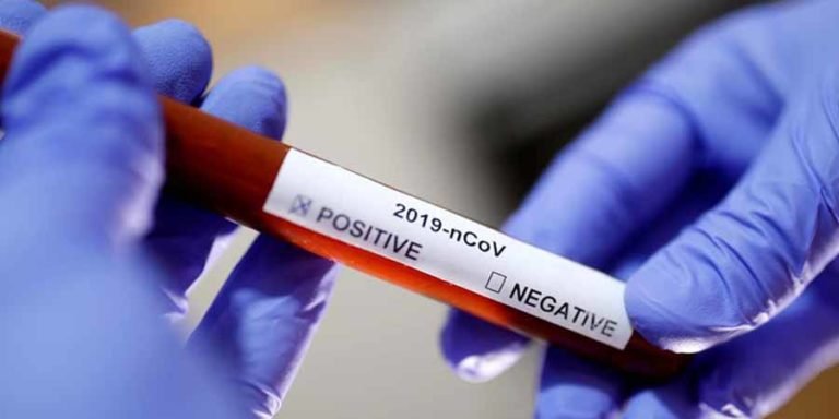 Coronavirus Lab