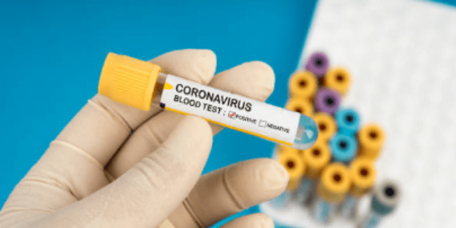 CORONAVIRUS