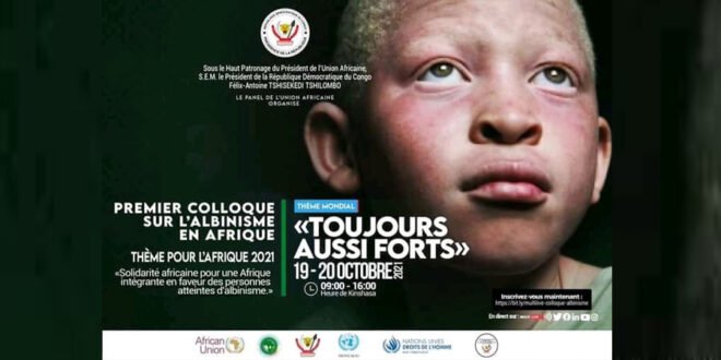 RDC : Du 19 au 20 octobre 2021, Kinshasa abritera le premier colloque panafricain sur l'albinisme